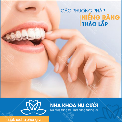 CÁC PHƯƠNG PHÁP NIỀNG RĂNG THÁO LẮP HIỆN NAY