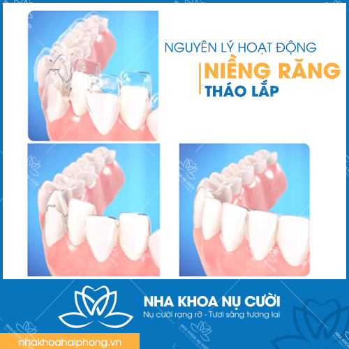 Nieng-rang-thao-lap-Hai-Phong