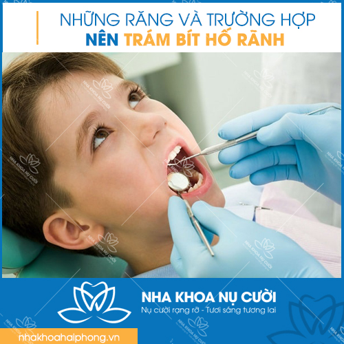tram-bit-ho-ranh-phong-ngua-sau-rang-hieu-qua-cho-tre