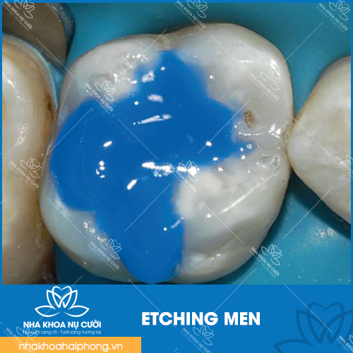 etching men