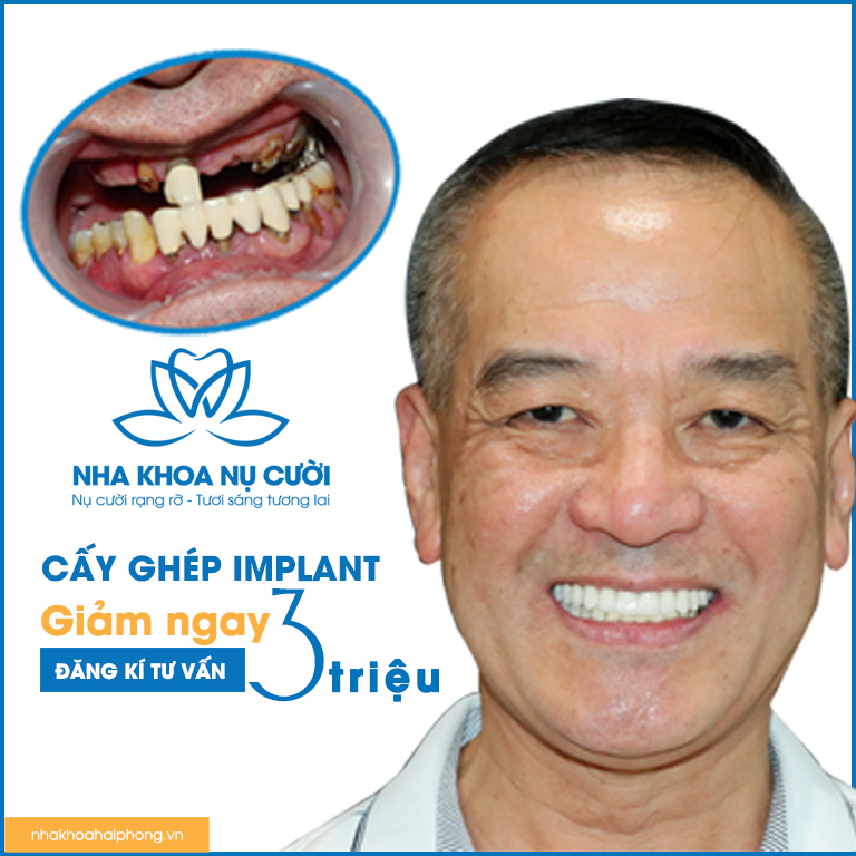 Chương trình khuyến mãi