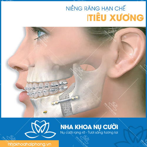 quan-niem-sai-lam-ve-nieng-rang