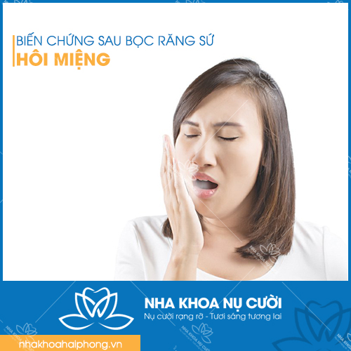 HOI-MIENG