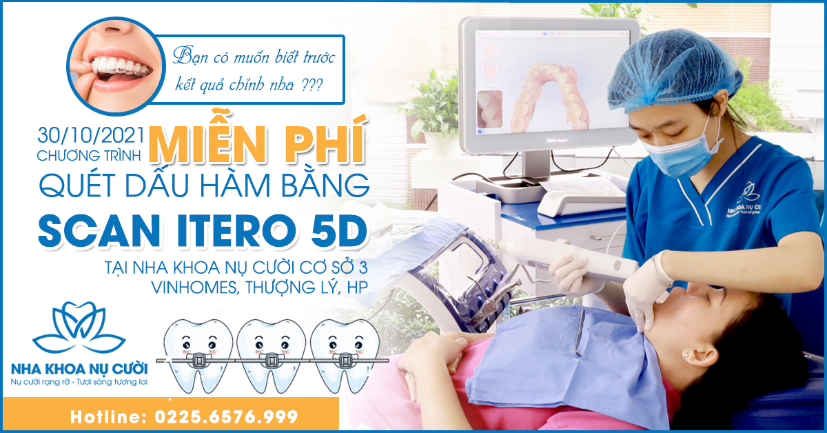 itero-5d-cong-nghe-quet-dau-ham-hien-dai-nhat-the-gioi