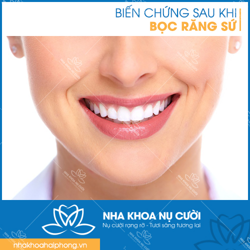 NHỮNG BIẾN CHỨNG SAU KHI BỌC RĂNG SỨ
