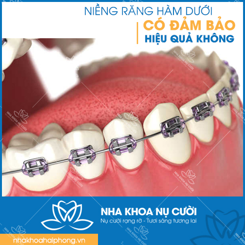 nieng-rang-ham-duoi-co-dam-bao-hieu-qua-khong