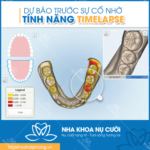 itero-5d-cong-nghe-quet-dau-ham-hien-dai-nhat-the-gioi