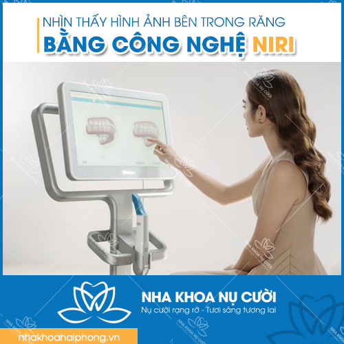 itero-5d-cong-nghe-quet-dau-ham-hien-dai-nhat-the-gioi