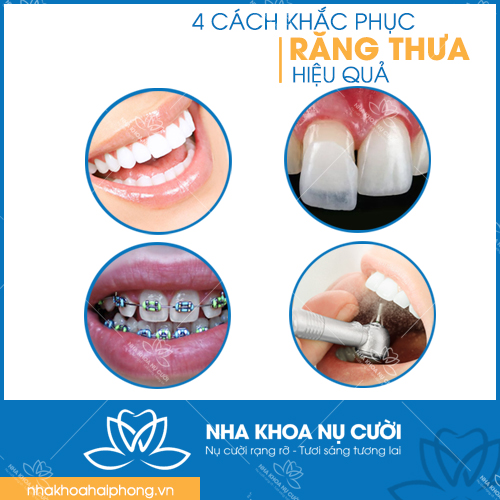 MÁCH BẠN 4 CÁCH KHẮC PHỤC RĂNG THƯA HIỆU QUẢ