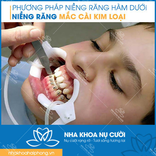 nieng-rang-ham-duoi-co-dam-bao-hieu-qua-khong