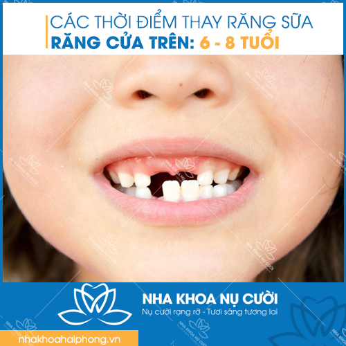 nho-rang-sua-dung-thoi-diem