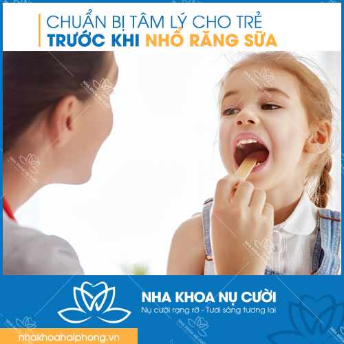 chuan-bi-cho-viec-nho-rang