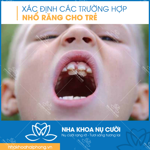 chuan-bi-cho-viec-nho-rang