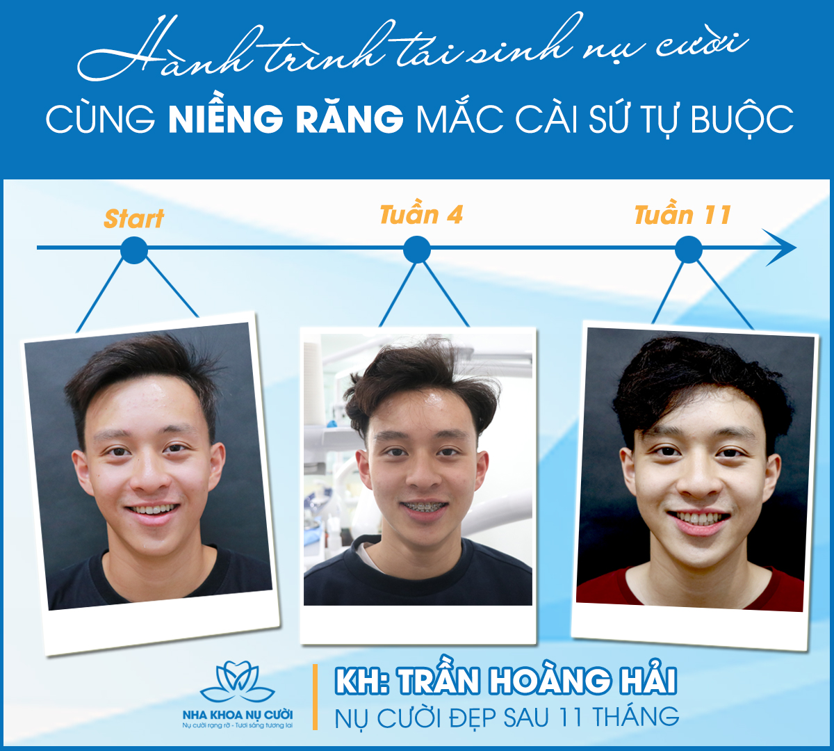 quan-niem-sai-lam-ve-nieng-rang