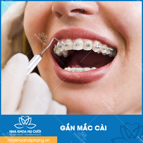 gan-mac-cai