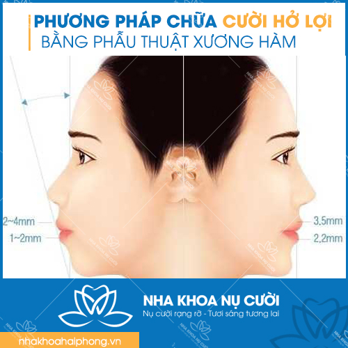 bằng tiêm chất giãn cơ