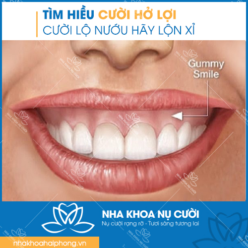 cuoi-ho-loi-la-gi