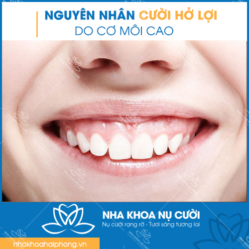 nguyen-nhan