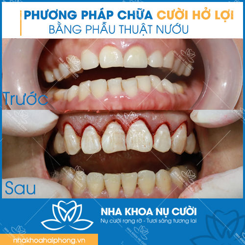 chua-cuoi-ho-loi-tai-hai-phong