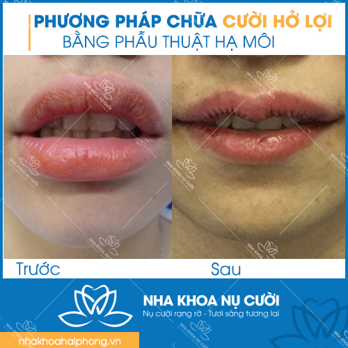 chua-cuoi-ho-loi-tai-hai-phong