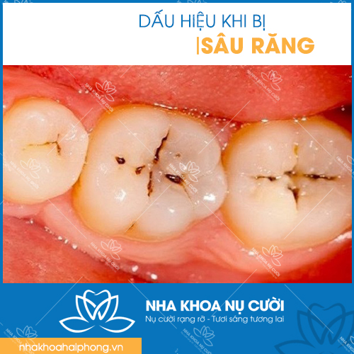 chua-sau-rang-tai-hai-phong