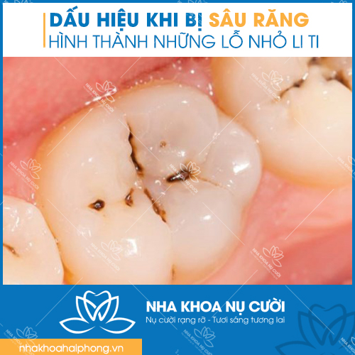 chua-sau-rang-tai-hai-phong