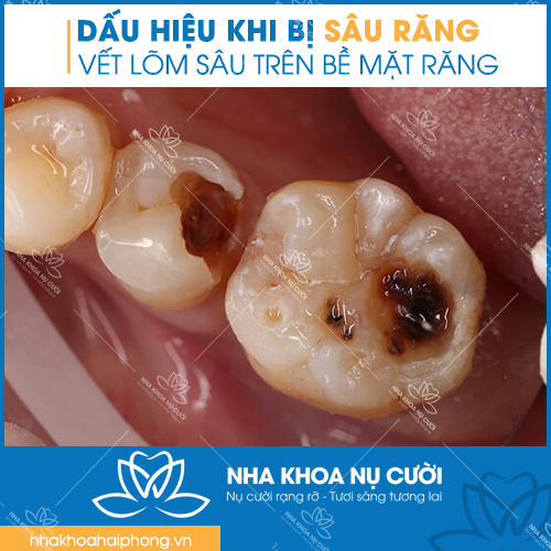 chua-sau-rang-tai-hai-phong