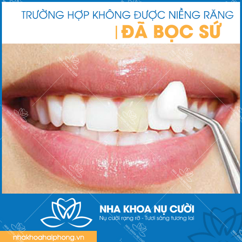 3-truong-hop-khong-duoc-nieng-rang-tham-my