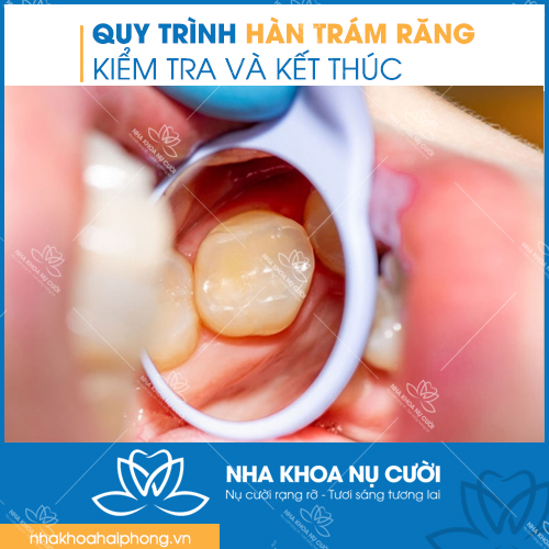 QUY-TRINH