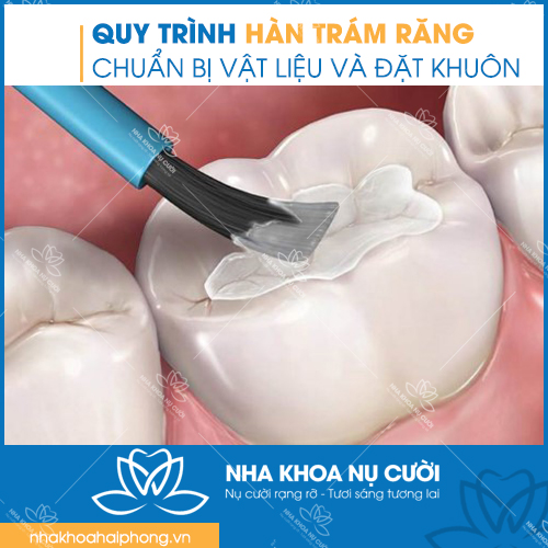 QUY-TRINH
