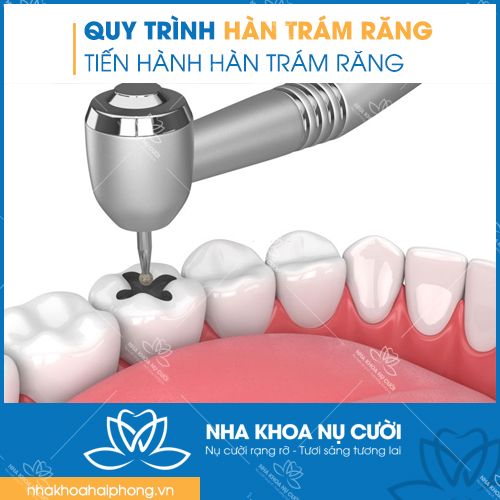 QUY-TRINH