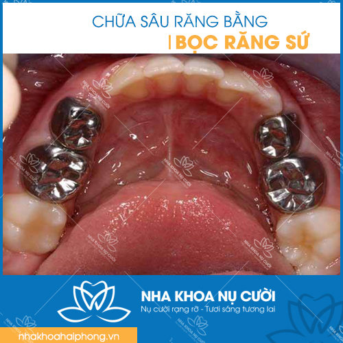CHUA-RĂNG-SAU
