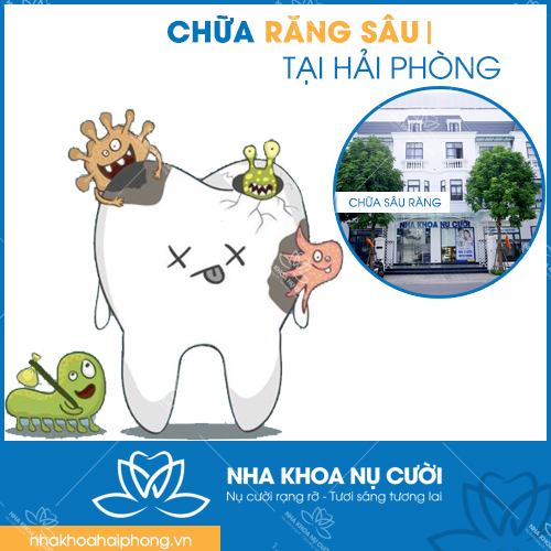 Chữa sâu răng tại Hải Phòng: Nguyên nhân, dấu hiệu và cách điều trị hiệu quả