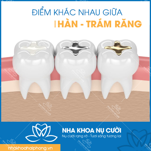 TRÁM RĂNG VÀ HÀN RĂNG KHÁC NHAU NHƯ THẾ NÀO