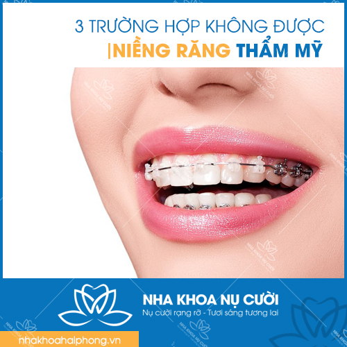 3 TRƯỜNG HỢP KHÔNG ĐƯỢC NIỀNG RĂNG THẨM MỸ