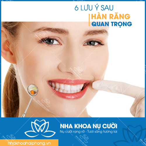 6-luu-y-quan-trong-sau-khi-han-rang