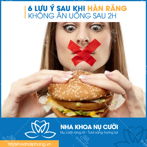 6-luu-y-quan-trong-sau-khi-han-rang