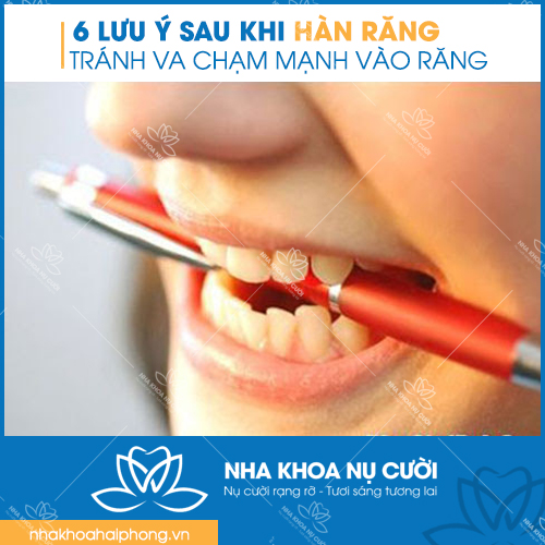 6-luu-y-quan-trong-sau-khi-han-rang