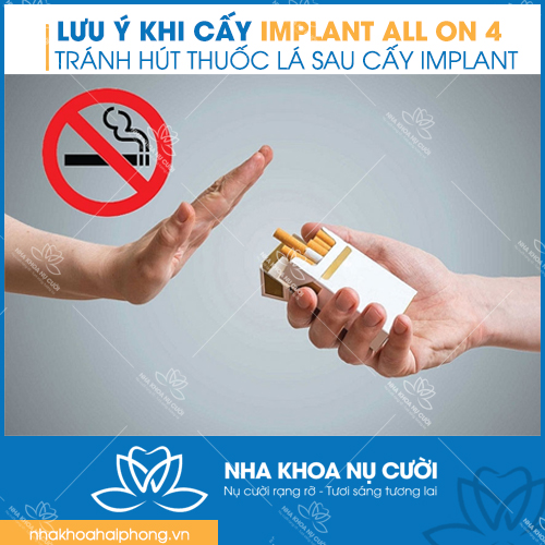 LUU-Y-SAU-CAY-GHEP-IMPLANT-ALL-ON-4