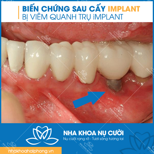 BIEN-CHUNG