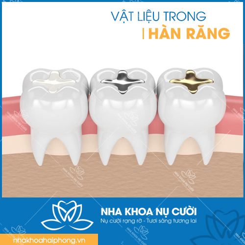 CÁC LOẠI VẬT LIỆU DÙNG TRONG HÀN RĂNG