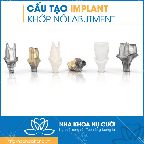 cau-tao-chuan-rang-Implant