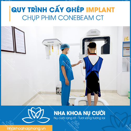 chup-xquang-ct