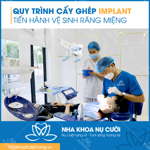 Quy-trinh-cay-ghep-implant-chuan-nha-khoa