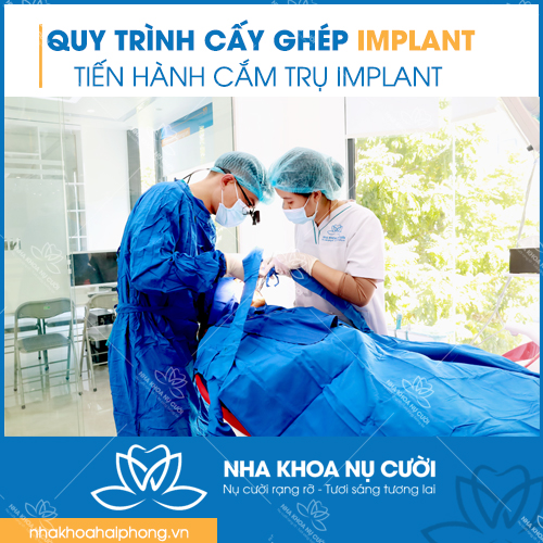cam-tru-implant