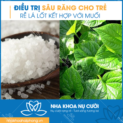 phuong-phap-dieu-tri-sau-rang-cho-tre-em-hieu-qua