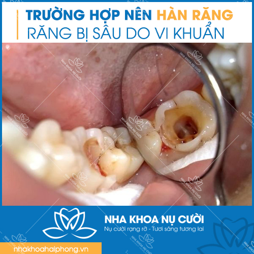 truong-hop