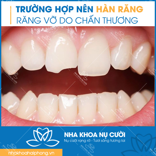 truong-hop