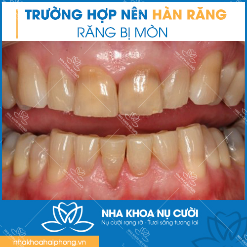 truong-hop