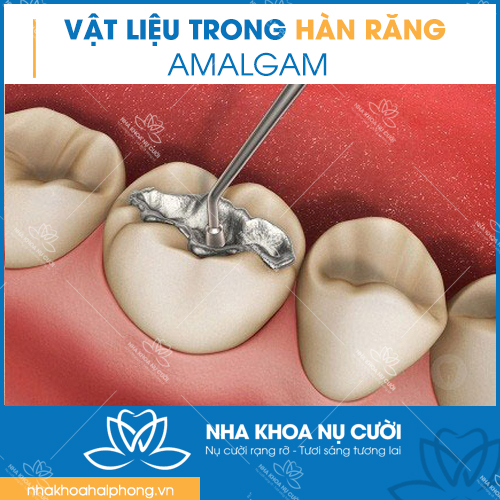 cac-loai-vat-lieu-dung-trong-han-rang